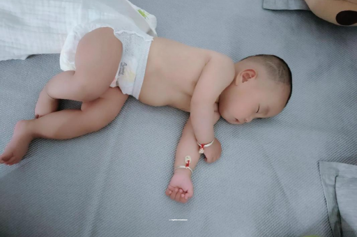 广元六个月宝宝眼睛散光